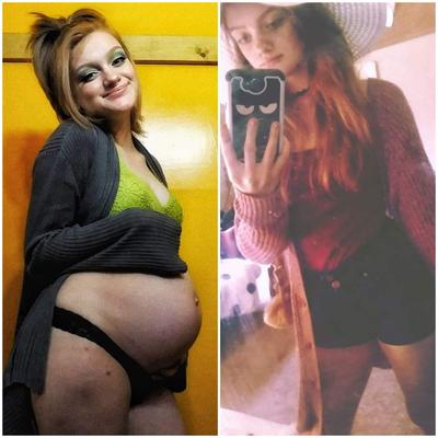 Pregnant teens - before and after 5