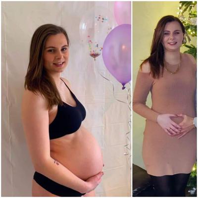 Pregnant - before and after 3