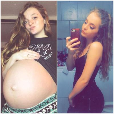 Pregnant teens - before and after 2