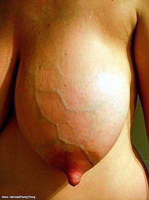 VASCULAR VIXENS: Assorted Veiny Breasts II