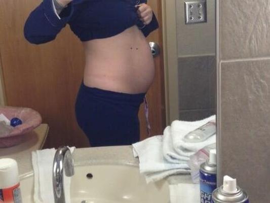 Postpartum belly