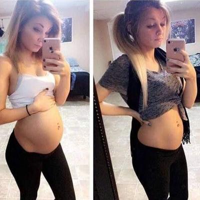 Pregnant at 18 #2