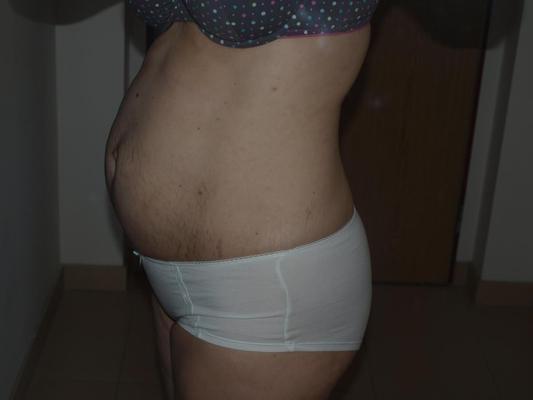 [Pregnant] woman shows off her belly